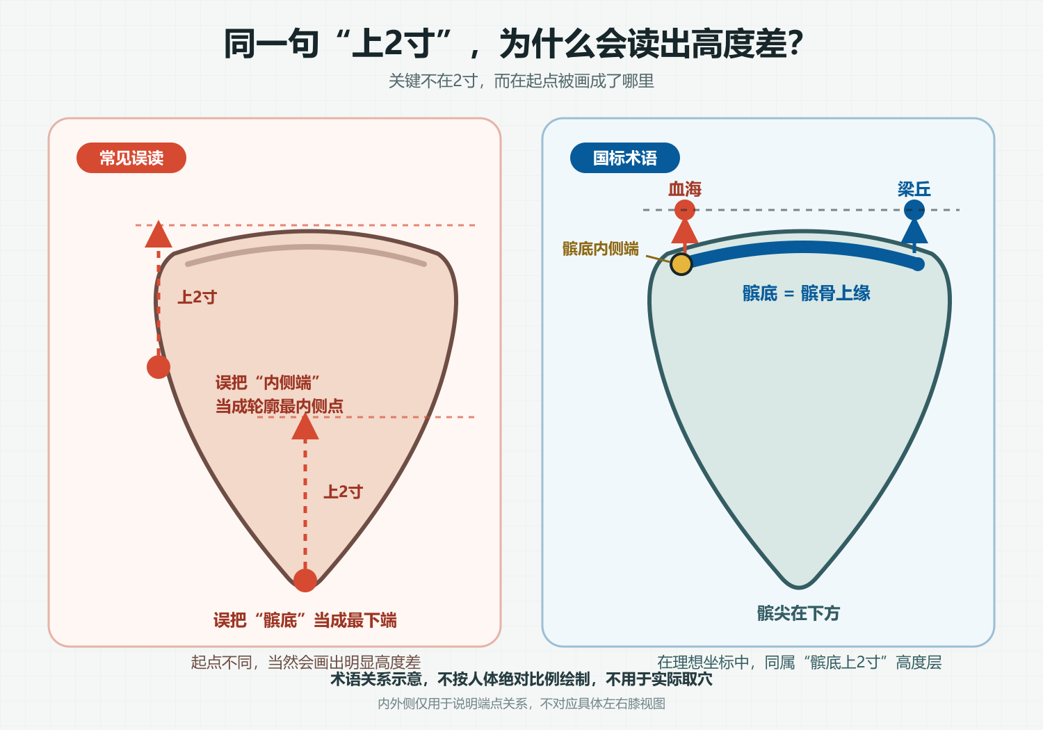 “髌底”与“髌底内侧端”的常见误读和国标术语关系